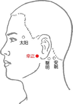 牽正穴|醫砭 » 中華針灸 » 牽正